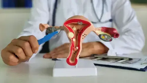 Cost of Uterine Fibroid Embolization